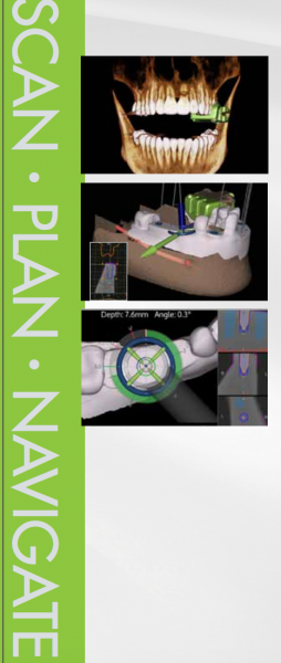 Scan Plan Navigate