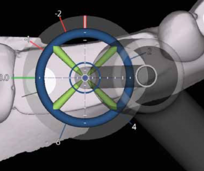 X-Point image with drill