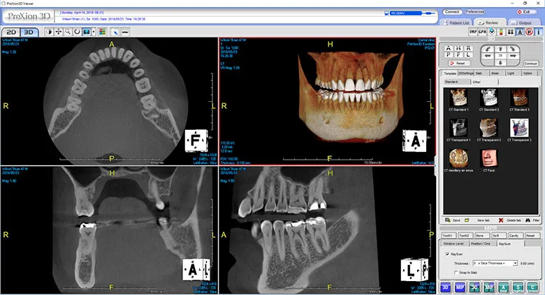 Cone Beam CT Imaging image